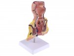 Verk 01626 Model ľudského hemoroidu - 5x zväčšené
