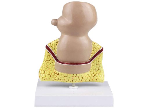 Verk 01626 Model lidského hemoroidu - 5x zvětšeno