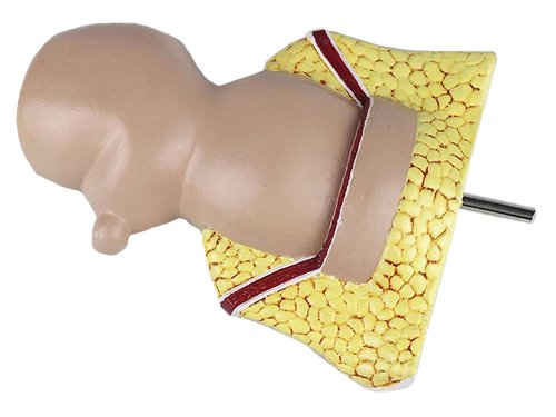 Verk 01626 Model ľudského hemoroidu - 5x zväčšené
