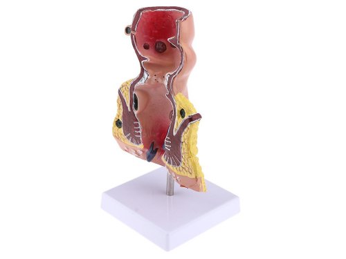 Verk 01626 Model ľudského hemoroidu - 5x zväčšené