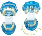 Verk 01964 Model zubních implantátů modrá