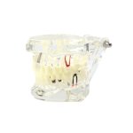 Verk 01964 Model zubných implantátov biela