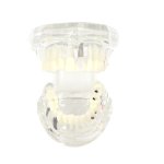 Verk 01964 Model zubných implantátov biela