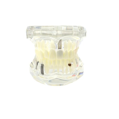 Verk 01964 Model zubných implantátov biela