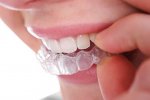 Malatec 22213 Chránič proti škrípaniu zubov 2 ks