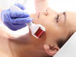Gordon G58 Derma valček mezoterapia 3 v 1 / 1,5, 1, 0,5 mm /