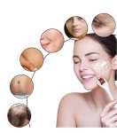 Gordon G58 Derma váleček mezoterapie 3 v 1 / 1,5, 1, 0,5 mm /