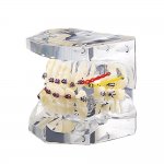 Verk 27403 Ortodontický model zubov