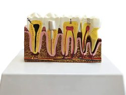 Verk 27614 Anatomický 3D model lidského zubu